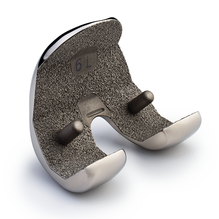 Persona® SoluTion™ PPS® Femur